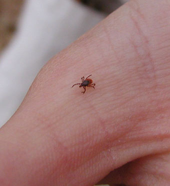 Black-legged ticks, the primary vectors of Lyme disease in the northeastern United States.: Photograph by K. Oggenfuss courtesy of NSF